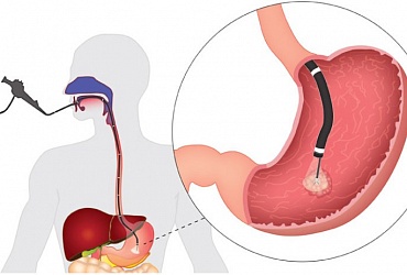 ЭНДОСКОПИЧЕСКИЕ ИССЛЕДОВАНИЯ. ПОДГОТОВКА.
