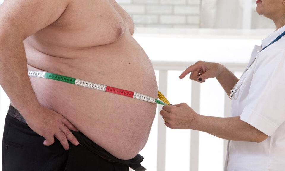 Что такое избыточный вес и ожирение?